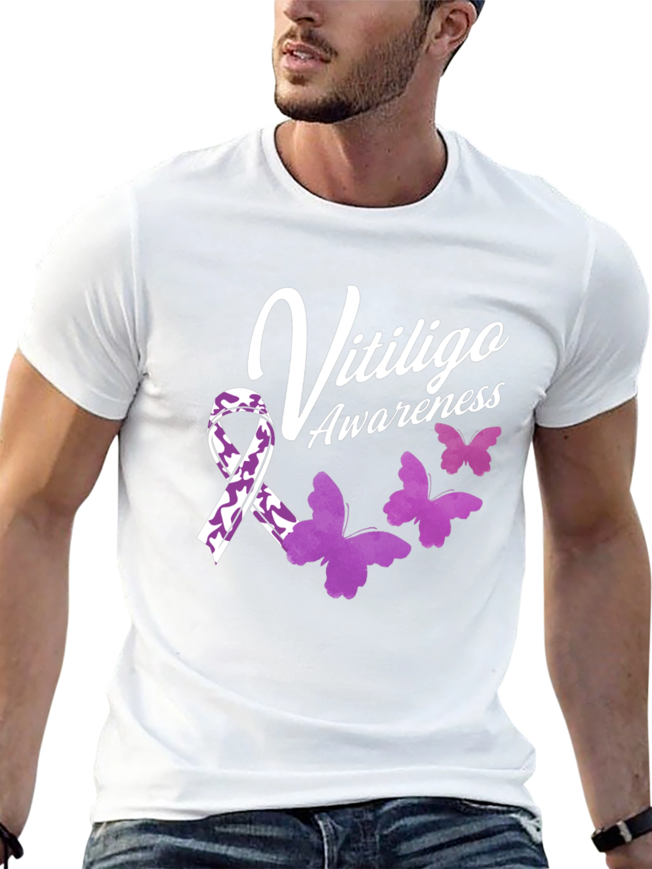 Vitiligo Awareness T-Shirt with Ribbon & Butterflies