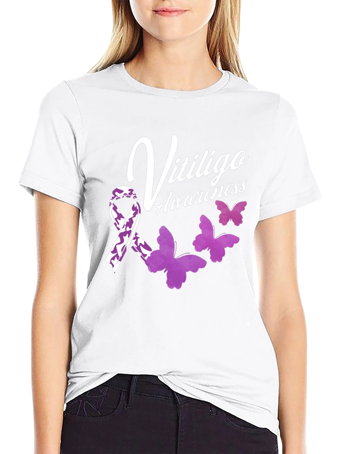 Vitiligo Awareness T-Shirt with Ribbon & Butterflies